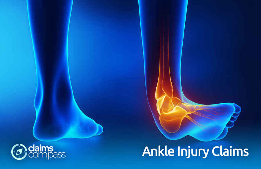 Ankle Injury Claims