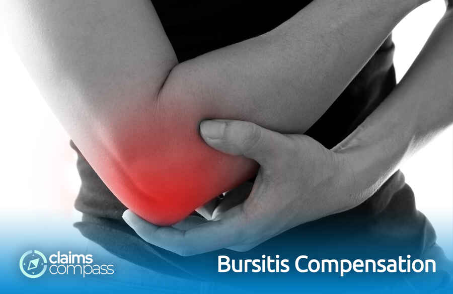 Bursitis Compensation