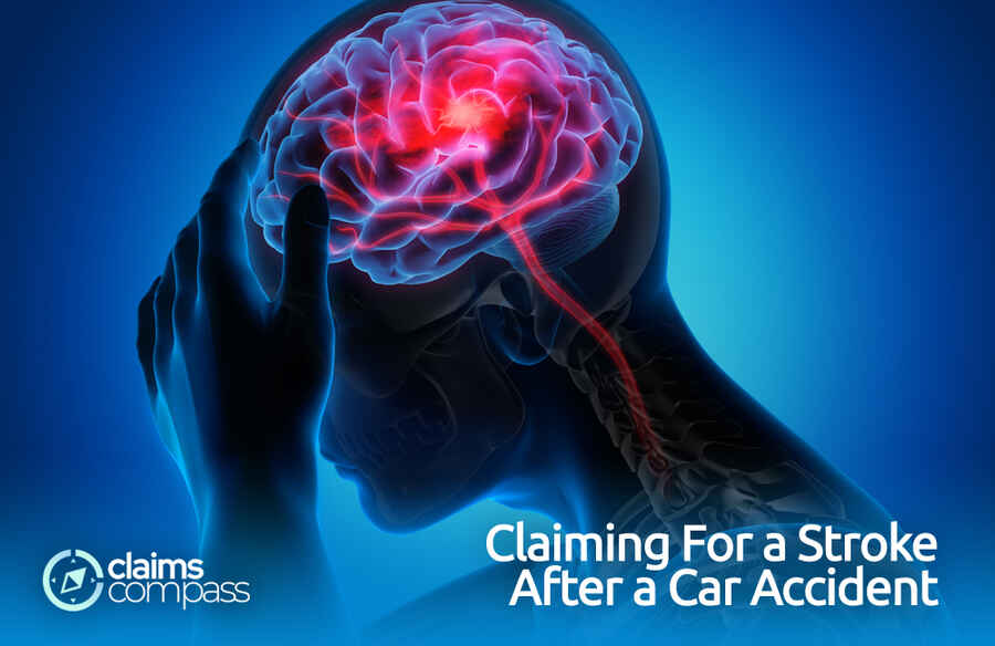 Claiming For a Stroke after a Car Accident