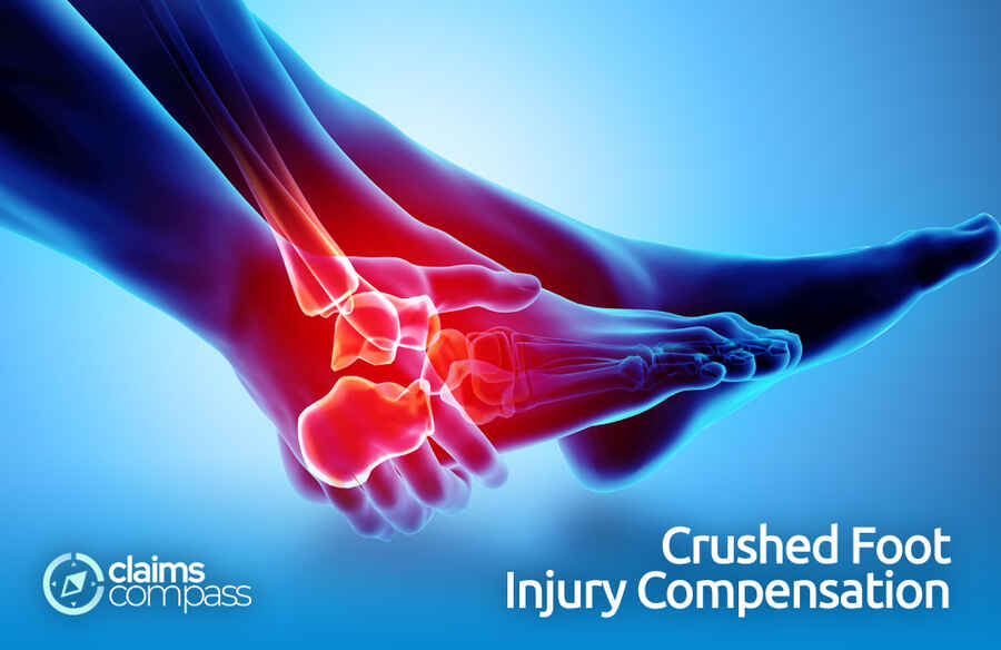 Crushed Foot Injury Compensation