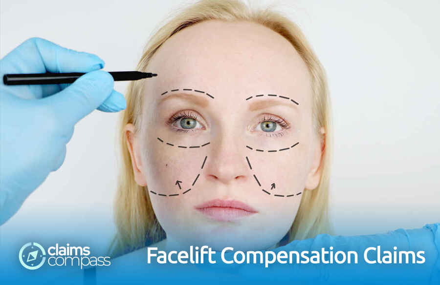 Facelift Compensation Claims