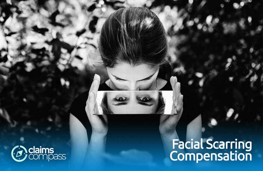 Facial Scarring Compensation