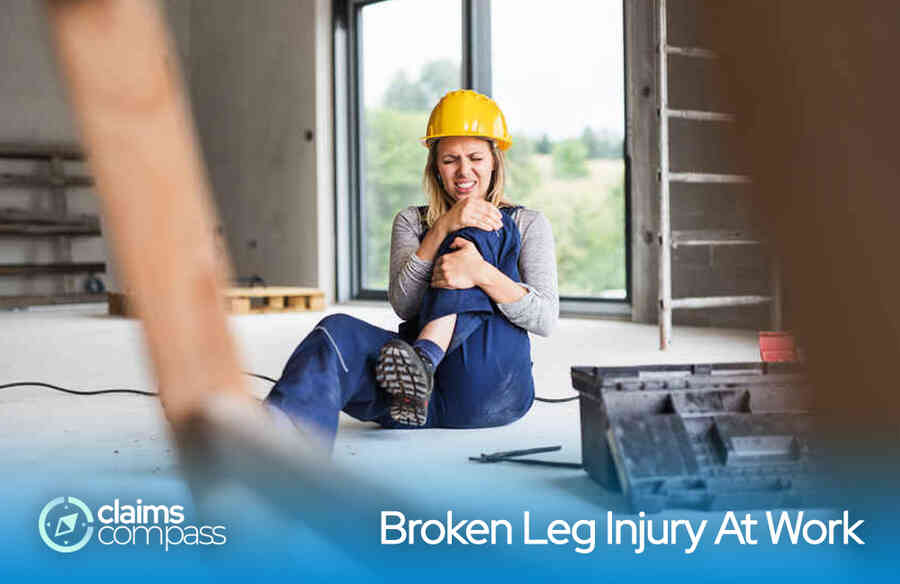 Broken Leg Injury At Work